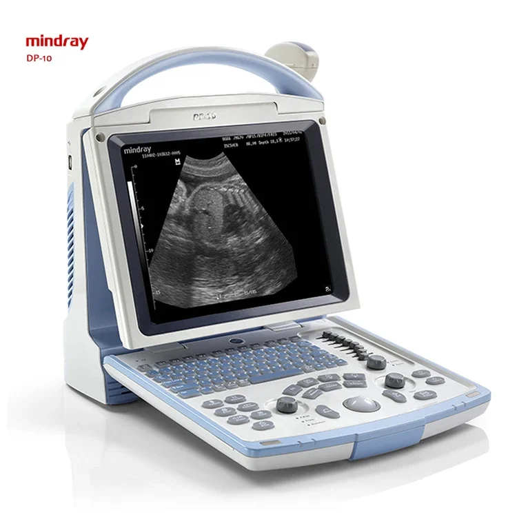 

Mindray DP-10 Medical Ultrasound Instruments Digital Diagnostic Portable Black White Ultrasound Machine MSL