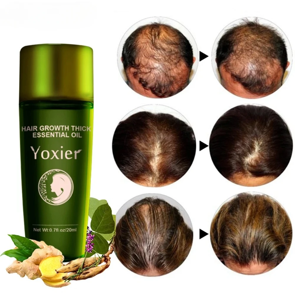 Fast Growth Hair Care Serum Herb Essential Oil Moisturizing Anti-Hair Loss Repair Anti-Dry Anti-Breaking Ginger Scalp Treatment