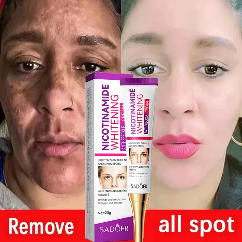 

Nicotinamide Whitening Freckles Face Cream Remove Melasma Dark Spots Corrector Fade Melanin Acne Anti-Aging Brighten Skin Care