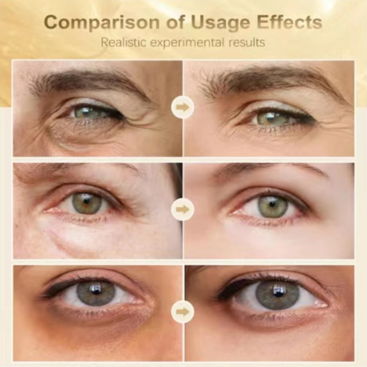 كريم العين EXE CREAM 010 مع الريتينول وحمض الهيالورونيك - مرطب وتنعيم وعلاج عين مضاد للشيخوخة #5