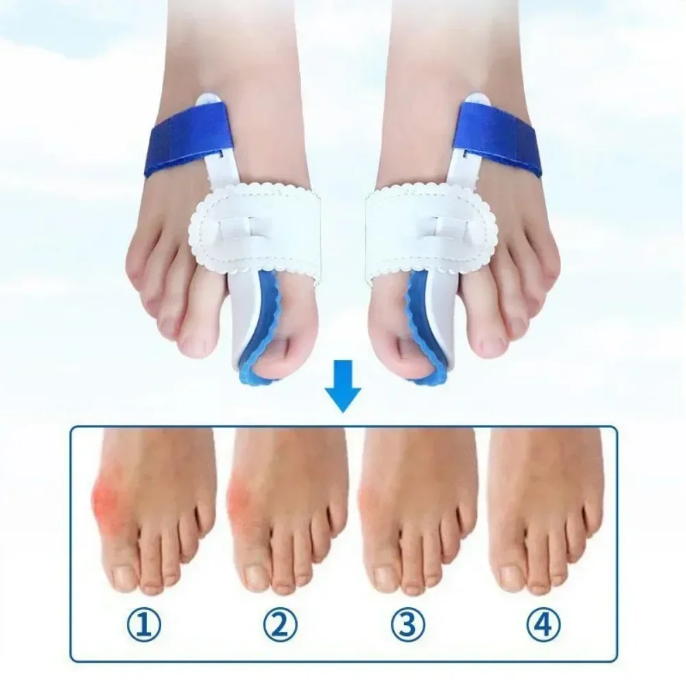 2 stücke Halux Valgus Corrector Fuß Für Zehen Separator Haluksy Ballen Hallux Valgus Zehenspreizer Separatoren Zehen Corrector Bunion
