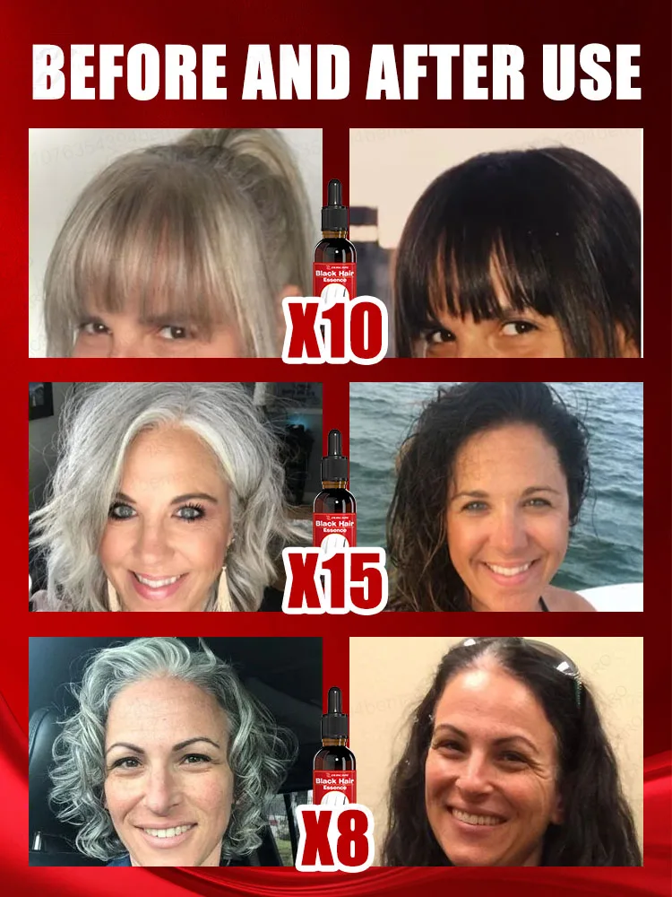 قل وداعاً للشعر الرمادي مما يجعلك تبدو أكبر، ويستعيد شعرك الأسود الطبيعي في 7 أيام. #2