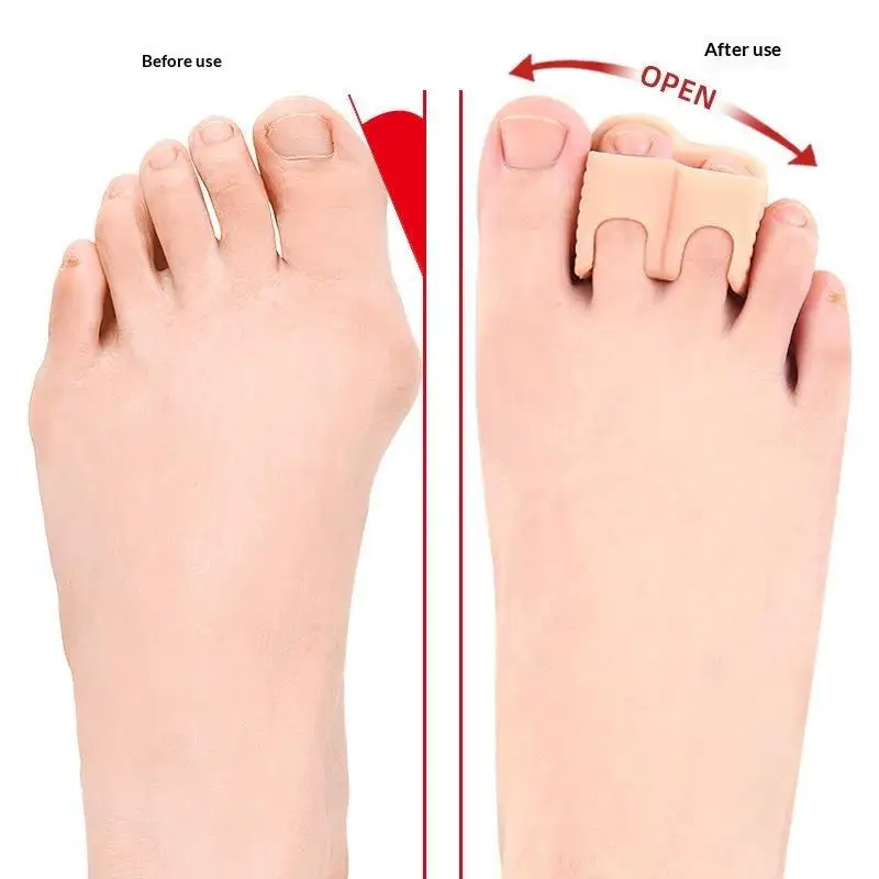 Weicher, elastischer Hallux-Valgus-Korrektor, 1 Paar Silikon-Zehentrenner, orthopädischer Schutz für den Nachtschlaf. – Detail 5
