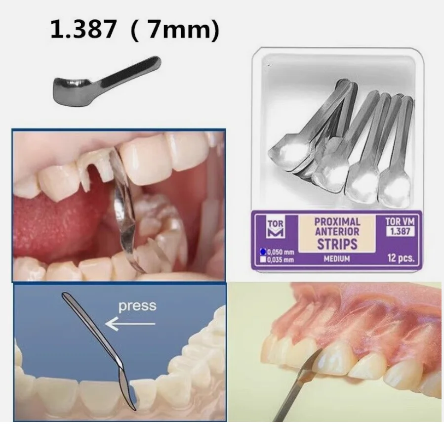 NIGF Tandheelkundige Matrixbanden Grote Kleine Twin Proximale Anterieure Strip Sectionele Voorgevormde Matrices Systemen Tandheelkunde Materialen