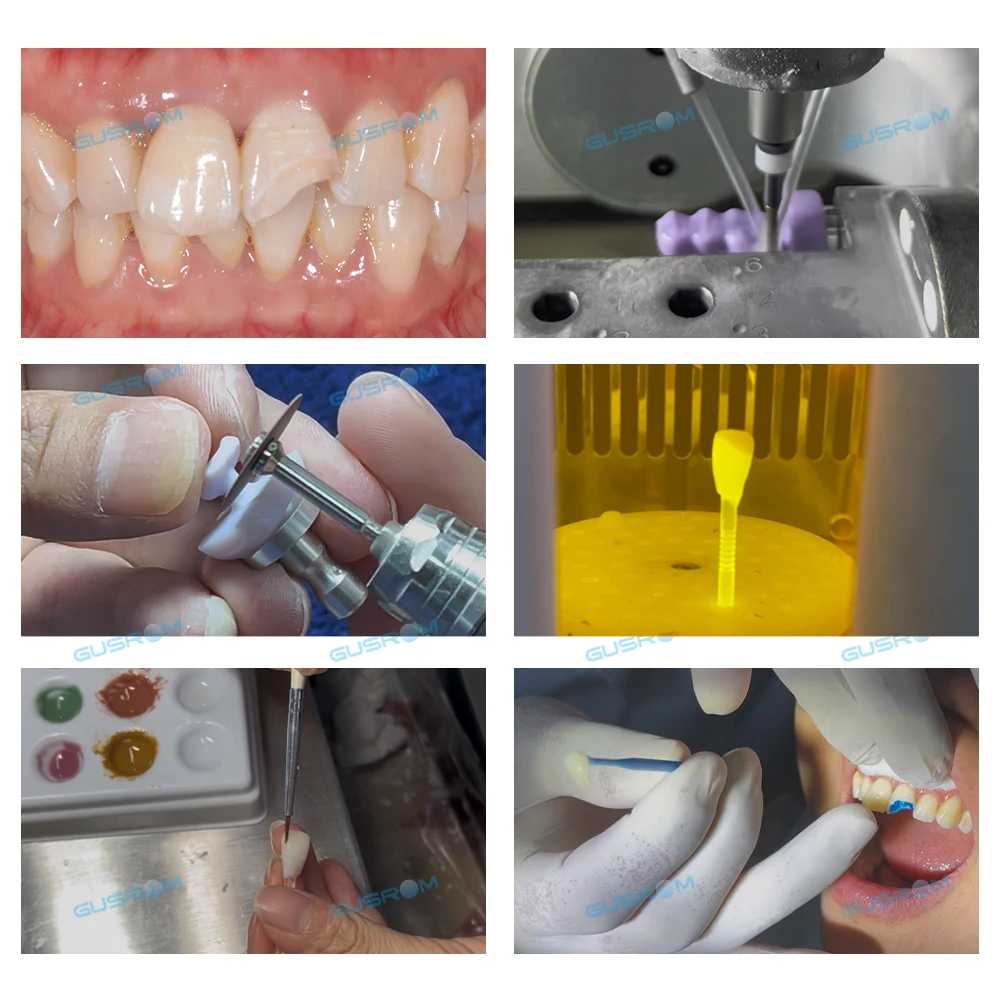 MT Lithium Disilicate Glass Ceramic Block C14 for CAD/CAM Sirona Cerec Veneer Crown Inlay Onlay Bridge Dental Lab Material 10Pcs