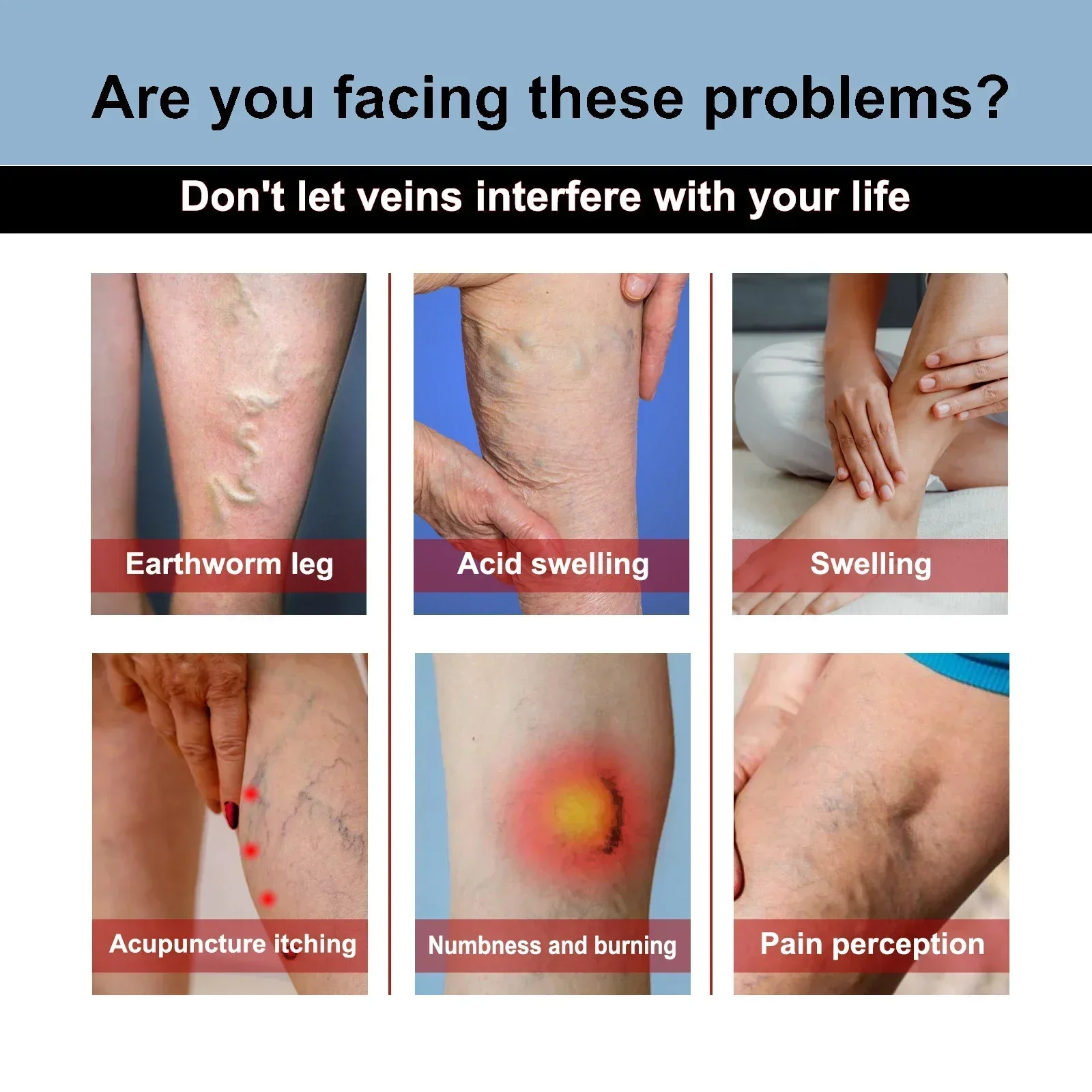 

Varicose Veins Ointmnet Vasculitis Phlebitis Spider Cream Varicosity Angiitis Removal Herbal Medical Plaster