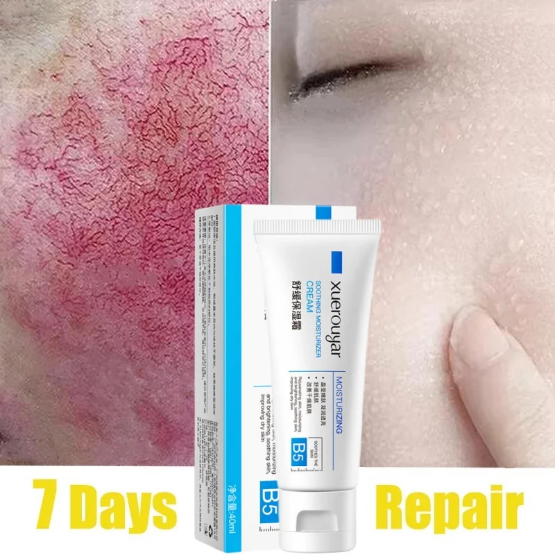 7 Day Repair Facial Redness Cream Soothing Redness Repair Skin Rosacea Red Blood Improve Sensitive Skin CareKorean Cosmetic