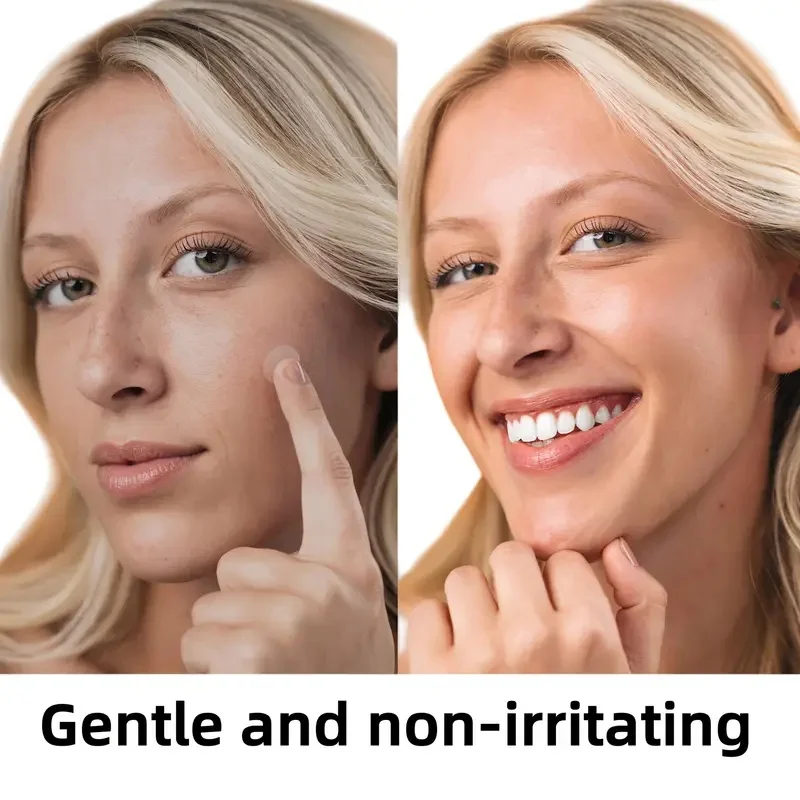 320 قطعة من بقع حب الشباب/رقع حب الشباب الغروانية المائية/لحب الشباب والعيوب والبثور/بدون بقايا/رقع حب الشباب/منتجات العناية بالوجه