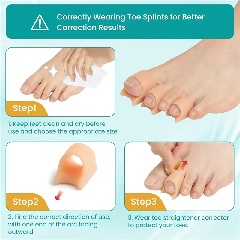 Alisador de dedos en martillo, corrector de dedos en martillo de 12 piezas para mujeres y hombres, férula para dedos con mangas de silicona de 3 tamaños