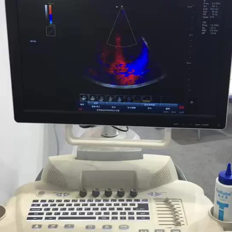 High end image quality the best professional OB GYN ultrasound  color doppler 3D ultrasound machine price