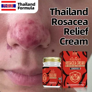 Rosacea Treatment Cream Blackhead Acne Remover Skin Care Anti Nose Mites Red Nose Repair Face Shrink Pores Thailand Formula