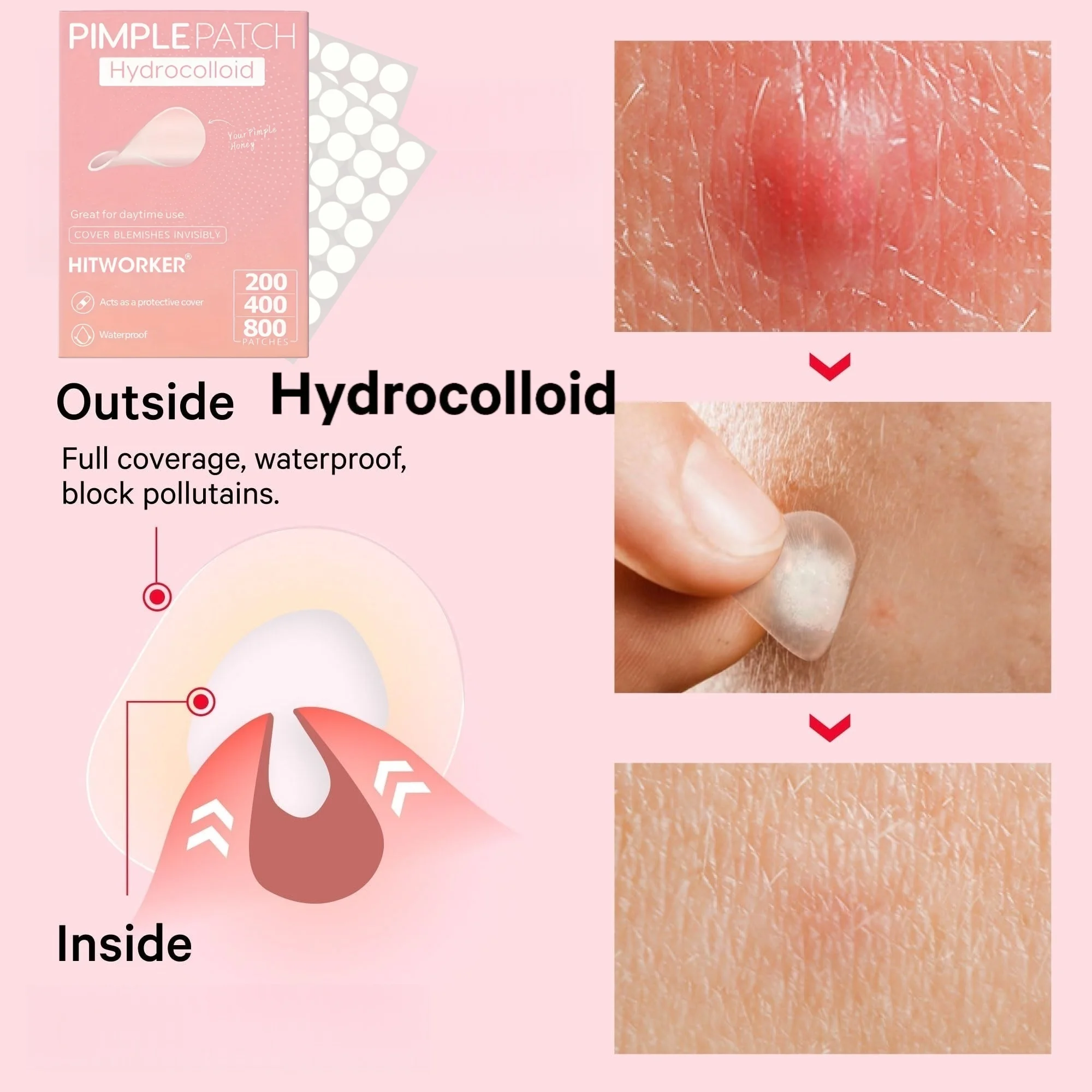 200/400/800 Pieces HITWORKER Hydrocolloid Acne Patches - Invisible, High-Quality Pimple Stickers with Salicylic Acid & Tea Tree