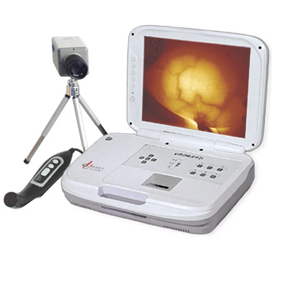 MCS-LEO-1201 Infrared Mammary Gland Diagnostic Instrument