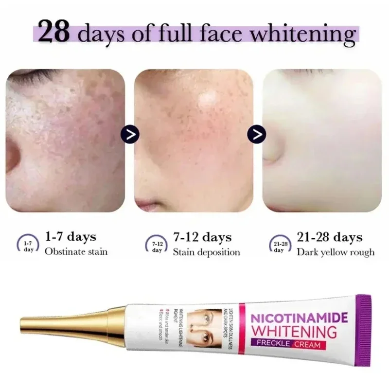 Fades Freckle Dark Spots Face Cream Niacinamide Lightening Cream Vitamin E Improve Dullness Fast Brighten Nourish Skin Product