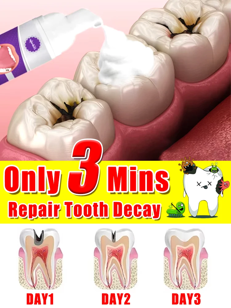 Hot selling Tooth Mousse repair tooth decay removal