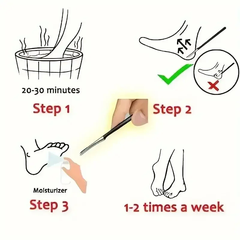 Pedicure  Knife Professional Special Nail Pedicure Tool Home Single Piece Skin Care Foot  Tool Beauty & Health