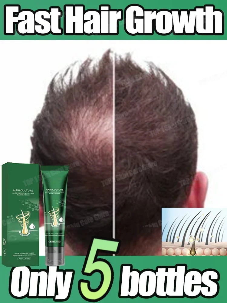 Hair Growth Essential Loss Regrowth Treatment Strengthens Hair Nourishes Scalp Light Weight Non Greasy Improve Scalp Circulation