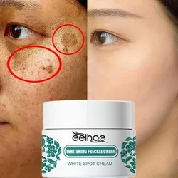 Niacinamide Melasma Brightening Cream Reduce Melanin Lighten Dark Skin Chloasma Serum Fade Fine Lines Face Care Products ﻿