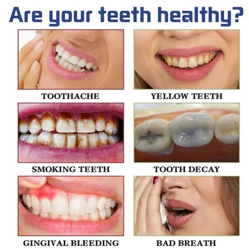 新鮮な歯のホワイトニングストリップ,歯磨き粉,歯垢の汚れを取り除き,口腔衛生,高速,歯科用ツール