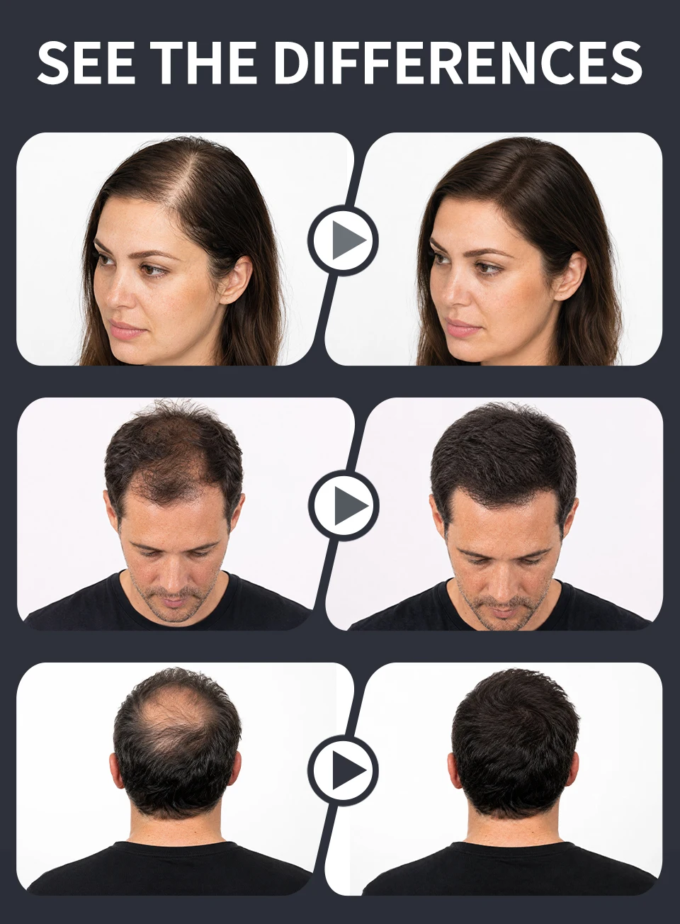 100g Haarausfall Aufbau Haar fasern Mixer verbergen Styling Faser Haar pulver Ausdünnung Keratin Wimpern verlängerung schwarz – Detail 8