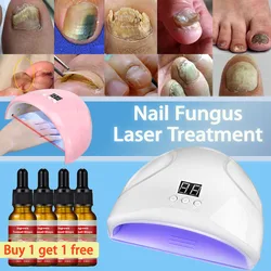 Fungal Nail Laser Device Effectively Fast Repair Toenail Fingernail Fungus Treatment Essence Anti-Infection Onychomycosis Laser