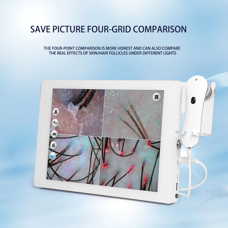 High Definition Skin & Scalp Analyzer Facial Care & Hair Follicle Detection Device for Beauty Clinics