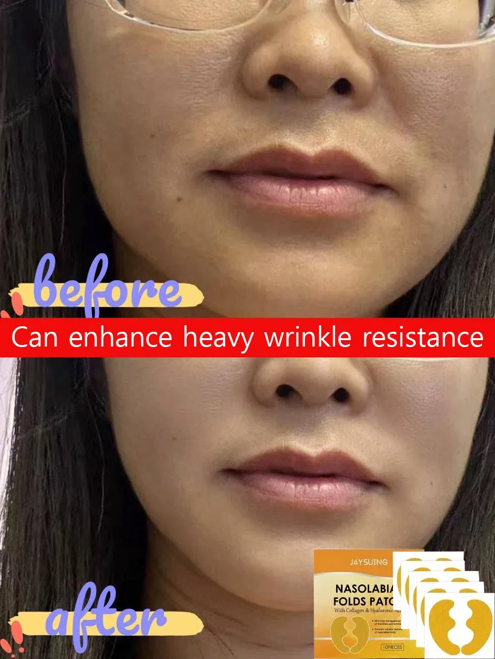 

Nasolabial Folds Patch Contain Collagen Hyaluronic Acid Firming Skin Fade Fine Lines Deep Moisturizing Facial Mask Anti Wrinkle
