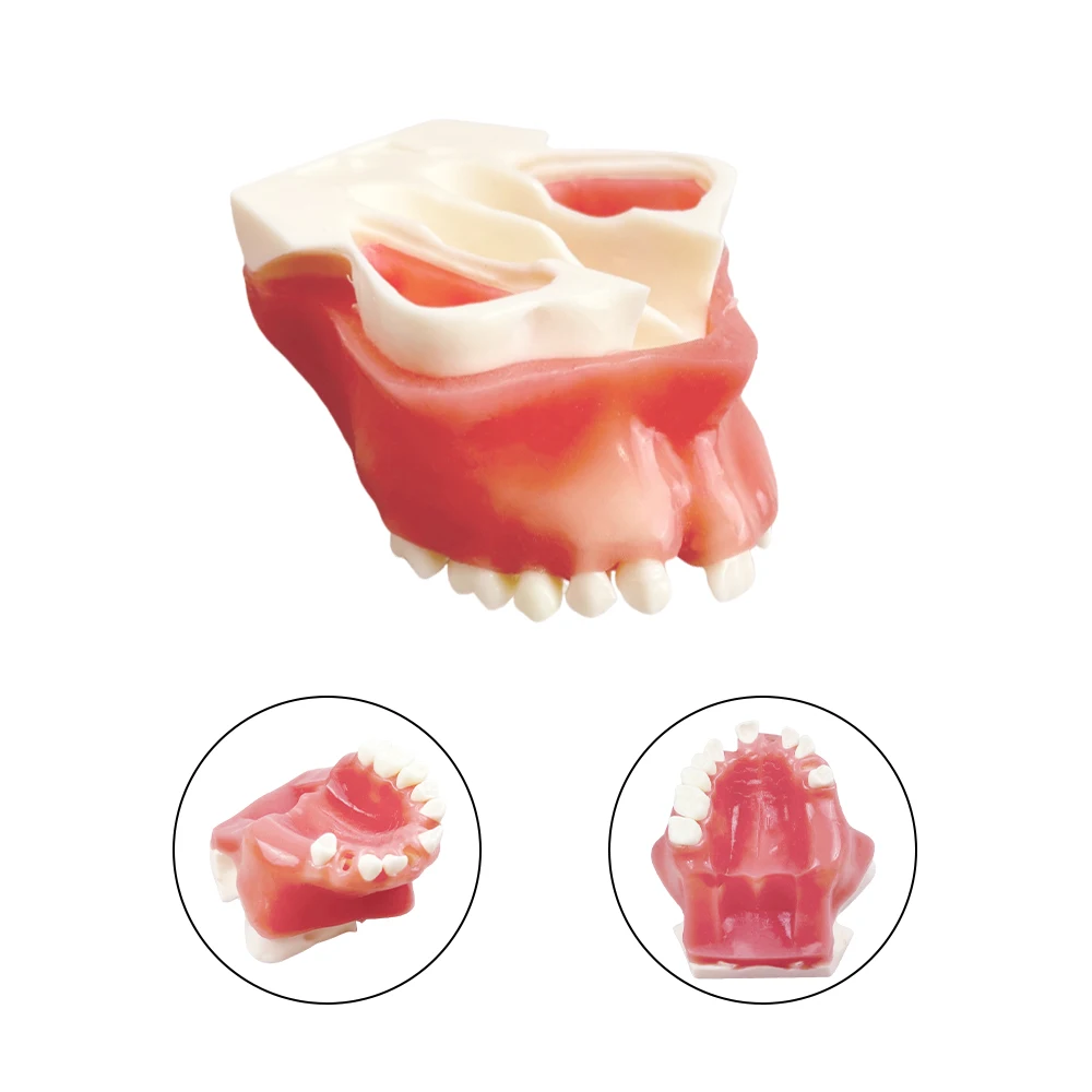 1 pz Impianto a bocca piena del seno massilare con modello di denti mancanti Modello di pratica didattica per studenti