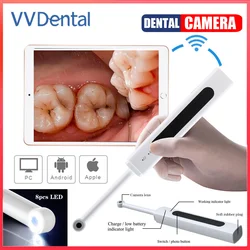 Câmera Intraoral Dental, endoscópio oral sem fio WiFi, 300W Pixel, Câmera de vídeo de alta definição, Espelho Intraoral Dental dos Dentes