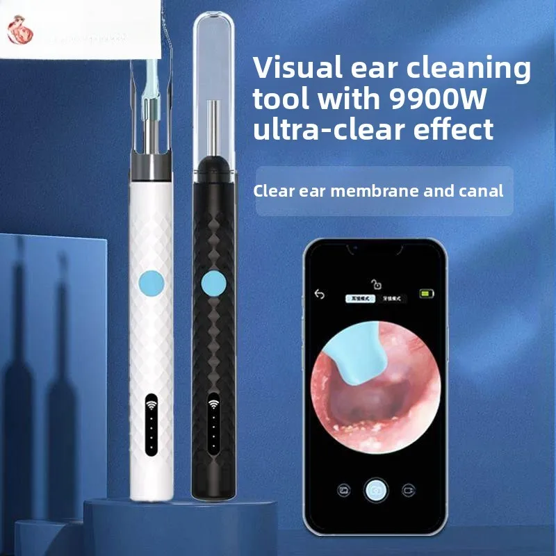 

Умная ухочистка высокой четкости с пинцетом, инструмент для визуальной чистки ушей, профессиональный, из нержавеющей стали, многоразовый