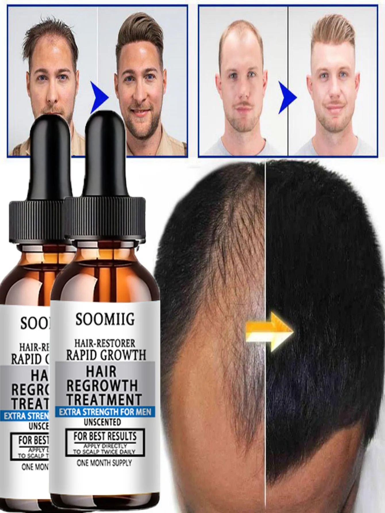 Ginger Hair Growth Essence Oils Products Anti Hair Loss Treatement Fast Growing Germinal Serum Prevent Scalp Damaged Men Women