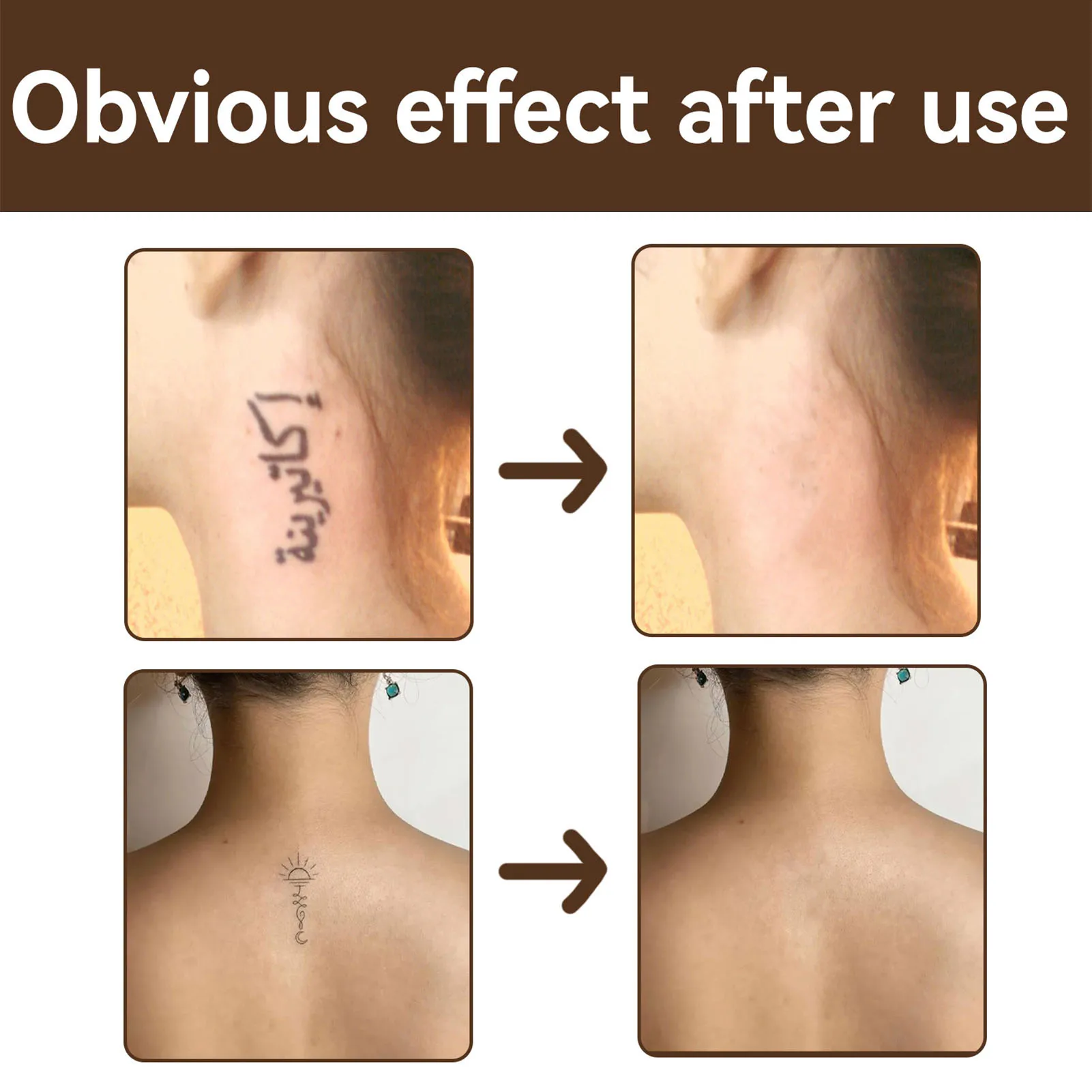 غطاء الوشم كريم الوشم المخفي المحمولة تجميل ضد الماء الجلد ندبة البقع الداكنة Birthmark المخفي للرجال النساء 0.7 أوقية #4