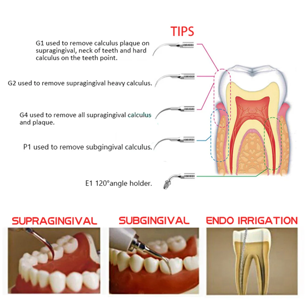 5PcНасадки для стоматологического ультразвукового скалера для EMS Woodpecker DTE Satelec Periodontics Endodontics G1 G2 G3 G4 G5 G6 G7 G8 P1 P3 Tool