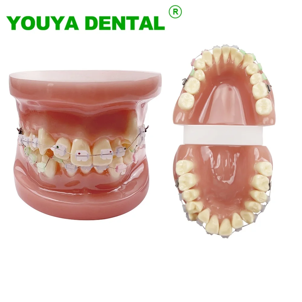 Dental Models For Patient Education Orthodontic Treatment Teeth Model With Ceramic Brackets Dentistry Teaching Study demo Model