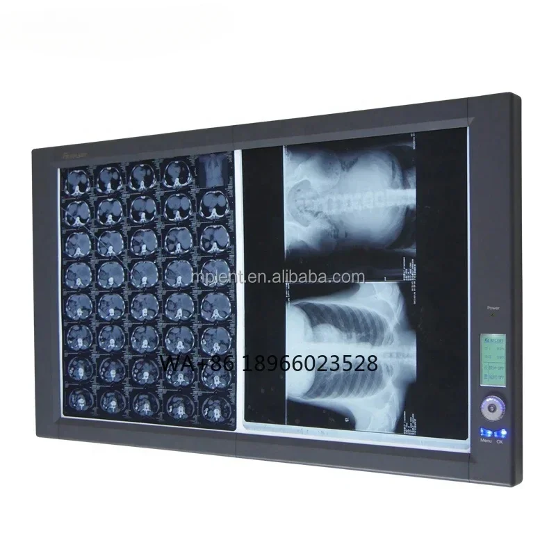 medical equipment for hospital Mplent Ultra Bright LED Negatoscope X-ray film viewer