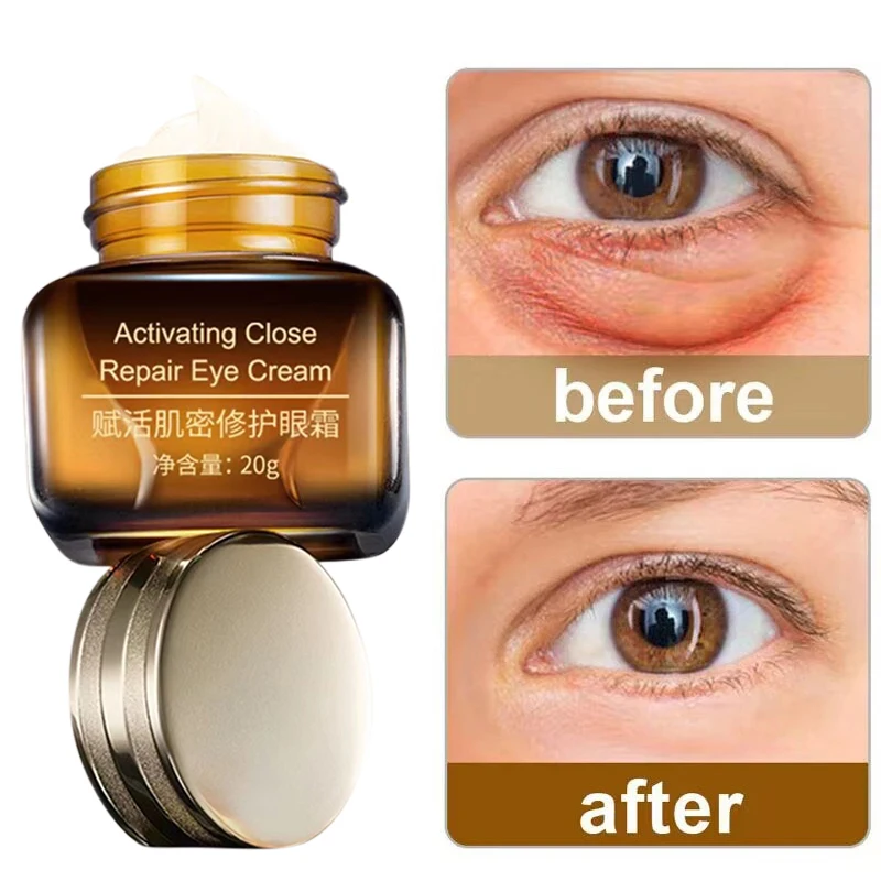 

Brown Bottle Anti-aging Repair Eye Cream Activating Close Nourishing Brightening Hydrating 20g Eye Cream Care For Dark Circles