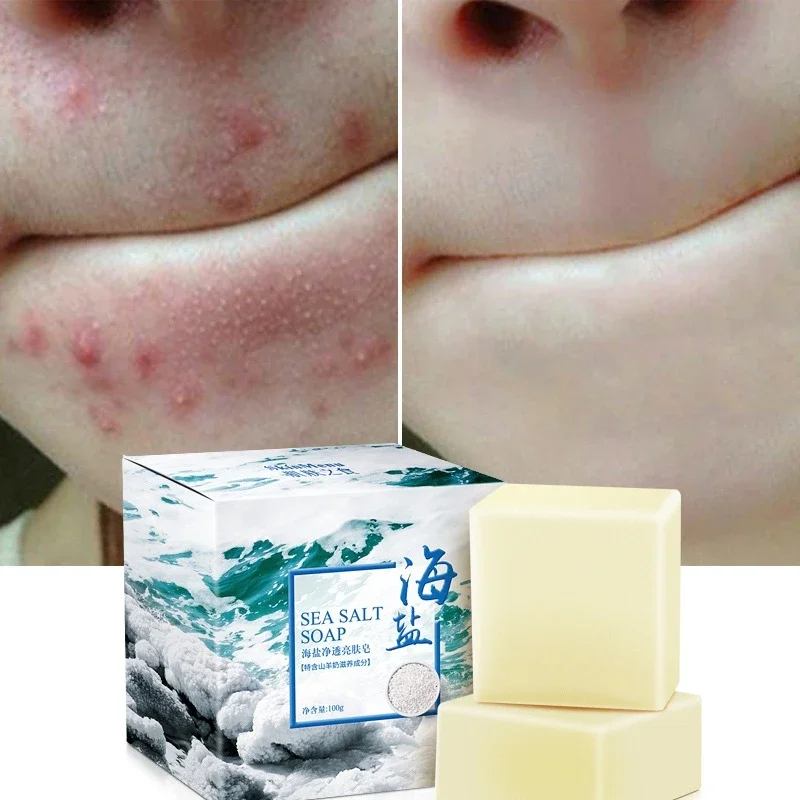 80g Salt Soap Mite Soap Rich In Sea Salt Quickly Remove Mites Repair Nourish Skin Personal Care for All skin types