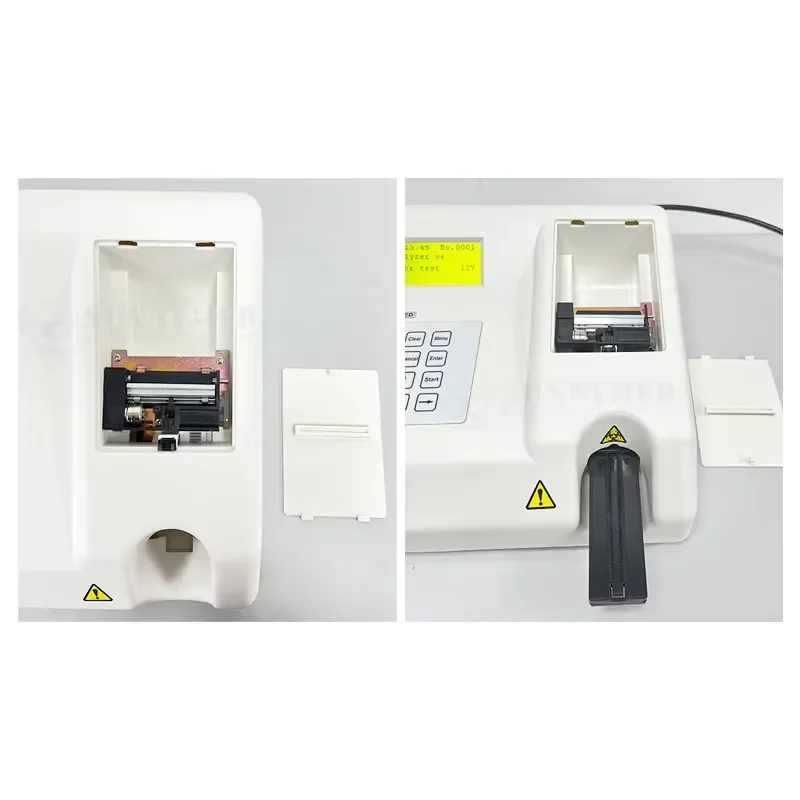 RCW SY-B015V Fully Automatic High Accuracy Urine Sediment Analyzer for Clinical Laboratory Microscopy Testing