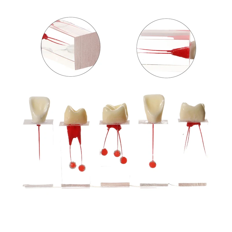 Endodontyczny model kanału korzeniowego dla studentów do nauki Szkolenie Stomatologia Edukacja Nauczanie Demo Model zębów Żywica Czerwony Biały