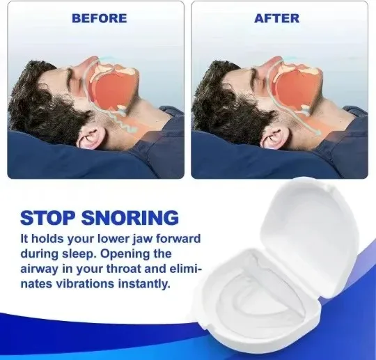 طقم مكافحة الشخير طحن المعبرة مكافحة الشخير mouith الحرس قالب مخصص وتعديل قابل للتعديل مع حقيبة تخزين snooring #6