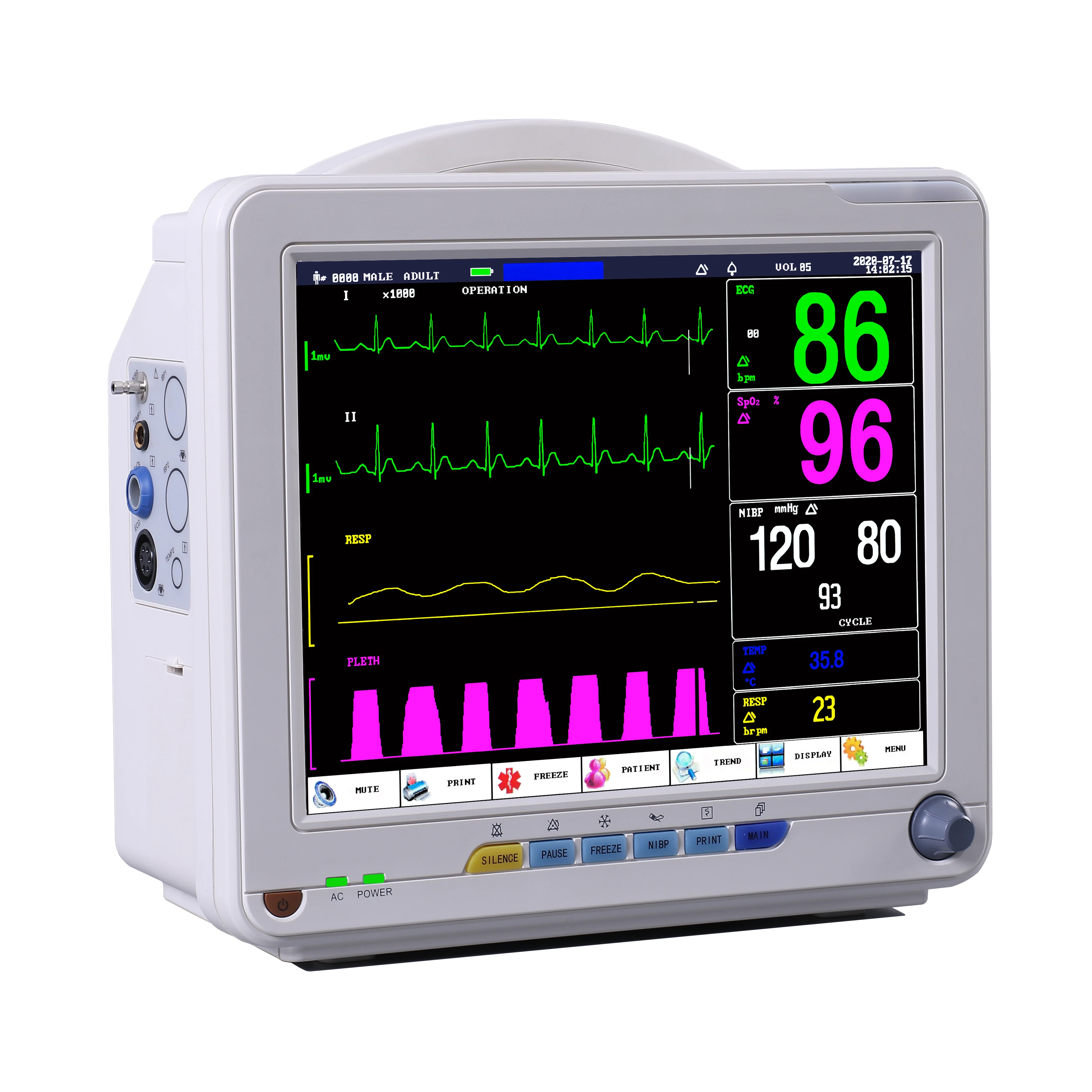 

12.1 Inch Portable Animal Vet ICU Multiparameter Monitor ECG ETCO2 Pet Monitor