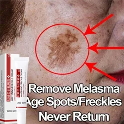 Effective Whitening Spot Cream Blemish Cream Moisturising Cream Fast Melasma Removal Melasma Lightening Melanin Cream New