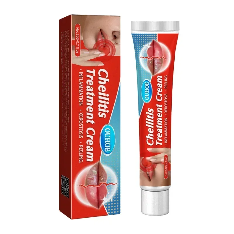 Cold Sores Lip Cheilitis Treatment Cream Herpes Antibacterials Ointment Chapped Lips Wrinkles Rehydration Plaster lip care