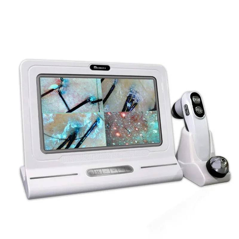 

Профессиональный детектор кожи и волос, анализатор волосяных фолликулов, влажности кожи, пор, пигментации, увеличительный анализатор, тестер пигментации кожи 11 дюймов