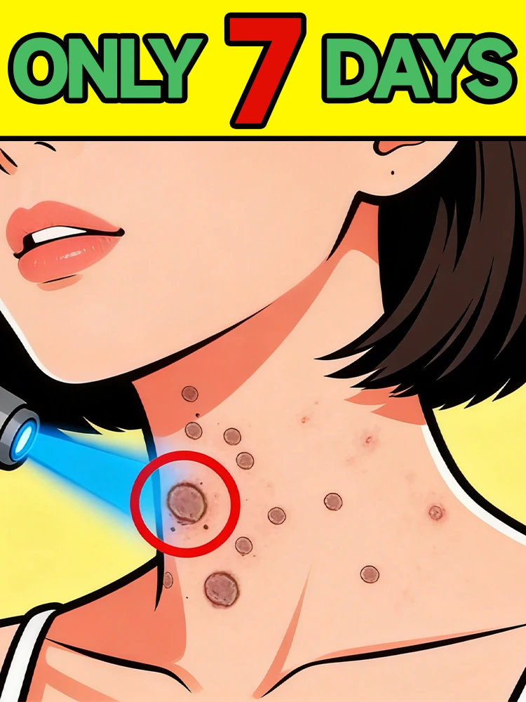 

Top-selling ʷᵃʳᵗ ʳᵉᵐᵒᵛᵃˡ ˡᵃˢᵉʳ device of 2025, painless design, 98% customer repurchase rate