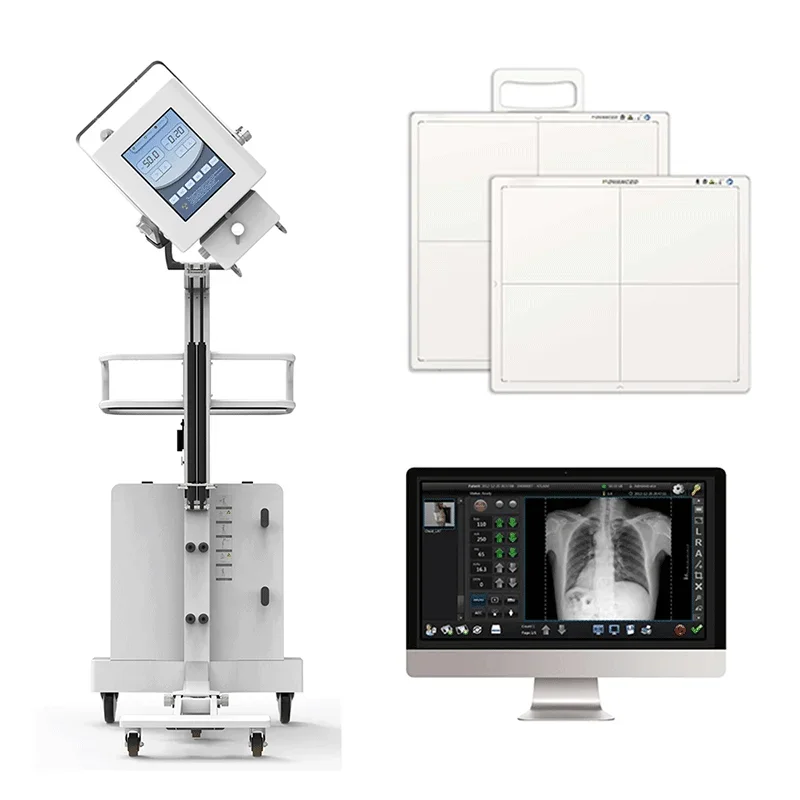 Iray Medical X-ray Equipment and Accessories Digital X-ray Machine Portable 17 * 17 Wireless Dr X-ray Flat Panel Detector