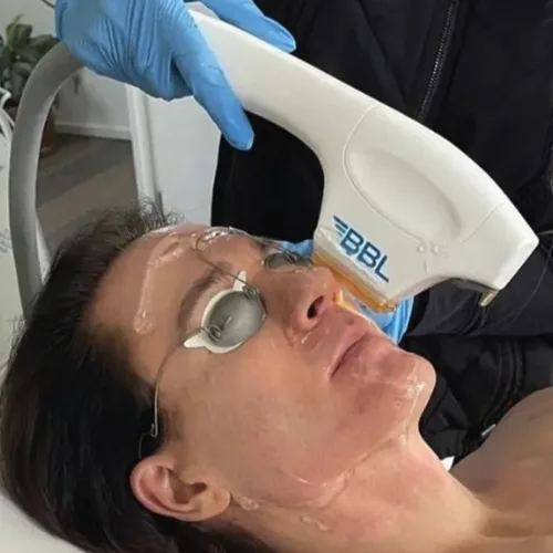 일회용 아이 패치, 레이저, IPL, LED, 스테인레스 스틸 안경, 190-11000nm, 50 쌍 