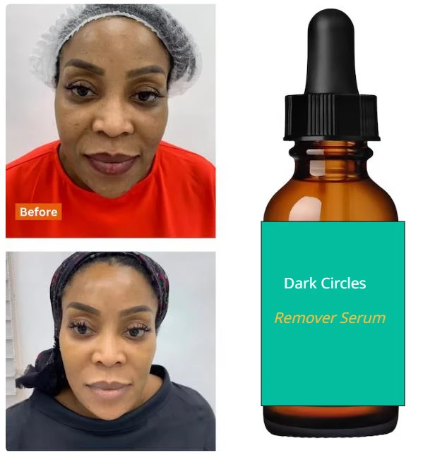 Under-eye brightening Serum for dark circles