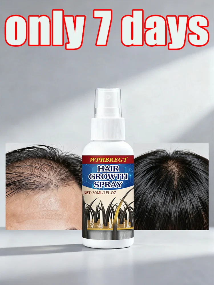 

HHc4oC2yelVaUpRQnz3yrI0QfQov97HhY4XFUS8oAc2N8TP6GMXO6cyCiGL8qQysHmfBvWzfzgohCeZqmBzzhO3lpw0aofupsVhN7BKPizstIra