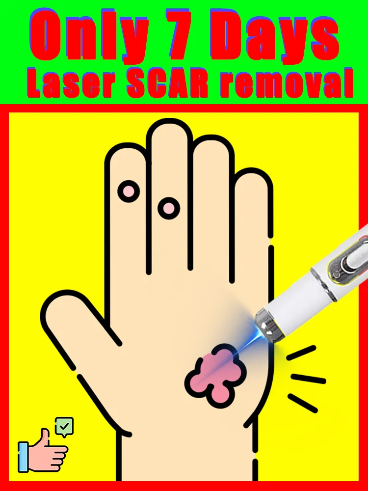 

[2025 hotsale]wart care tools,blue light pen solve warts,beauty,free shipping,quickly